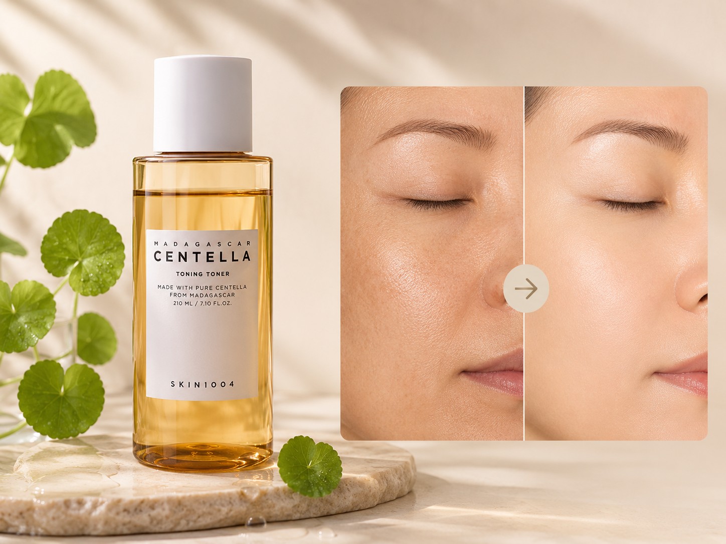 SKIN1004 Madagascar Centella Toning Toner avec comparaison visuelle d’un grain de peau avant et après.